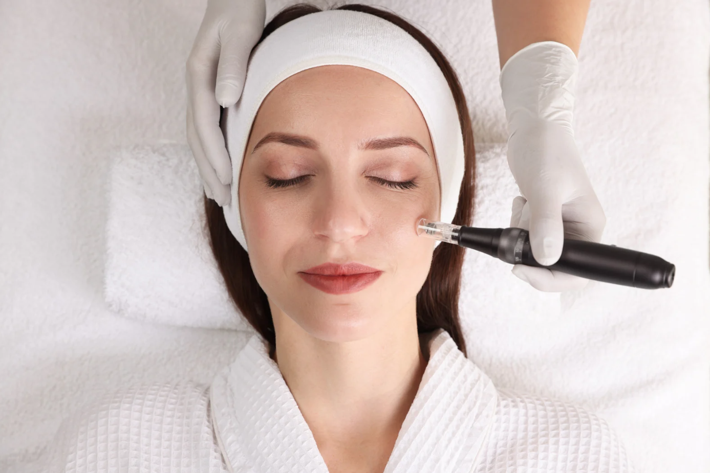 Microneedling